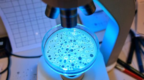 Temps d'incubation de la mononucléose : tout savoir